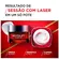 Creme L oréal Revitalift Laser X3 Anti-idade Diurno 50g